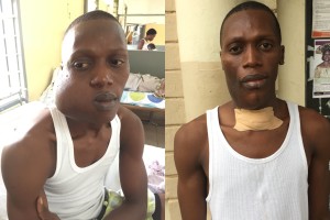Amadu voor zijn operatie (links) en na zijn operatie (rechts)
