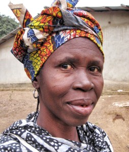 Sasanto, age 55, after recovering from bilateral cataract surgery in February 2012.