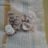 Umaru Toronka’s bladder stones, , Aug. 4, 2017, soon after removal., IMG-20170804-WA0007 (5)